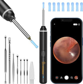 VITCOCO Ear Wax Removal Kit, 1920P HD Ear Cleaner with Camera Ear Wax Remover IL
