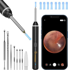 VITCOCO Ear Wax Removal Kit, 1920P HD Ear Cleaner with Camera Ear Wax Remover IL