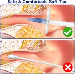 Ear Wax Removal Kit, XaYis Ear Cleaner, Ear Wax Remover with Soft Quad-Stream Ti