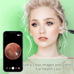 VITCOCO Ear Wax Removal Kit, 1920P HD Ear Cleaner with Camera Ear Wax Remover IL